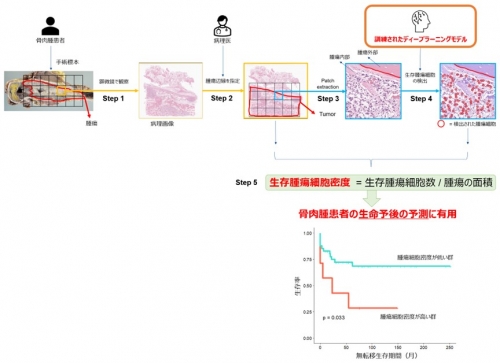 ⾻⾁腫診療へ⼈⼯知能を応⽤～化学療法後の病理組織をディープラーニングにより評価～