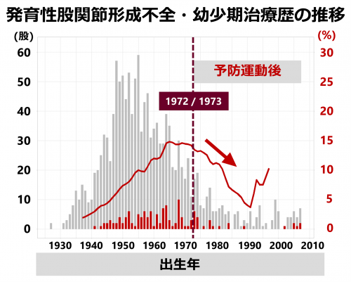 乳児股関節脱臼を激減させた予防運動の価値をライフコース疫学で解明～胎児・新生児から始まる成人期の運動器疾患の予防法に期待～