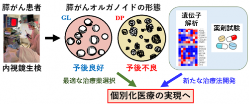 オルガノイド技術により膵がんのサブタイプ分類と予後予測に成功～膵がん治療の最適化と新たな治療法の開発に期待～
