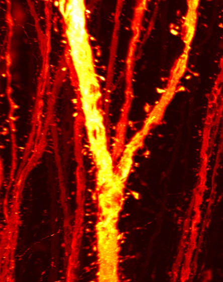 思春期における大脳皮質のシナプス形成が高次脳機能発達の鍵～統合失調症の病態メカニズムにも新説～
