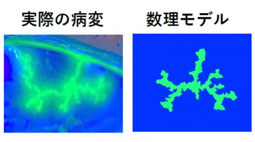 角膜炎の形を「数式」で説明－角膜ヘルペスの多様な病変の形を数理モデルで再現－