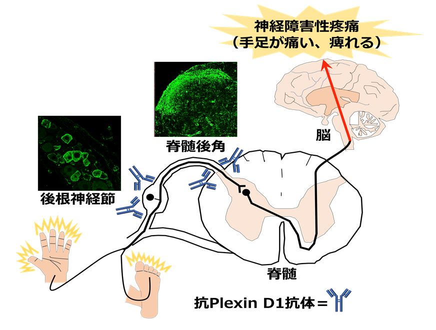Amazon.co.jp: PAIN～ 神経生理学に基づく痛みのマネジメント