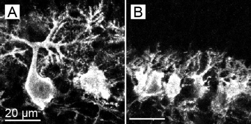 ブラキシズムの臨床 : その発生要因と臨床的対応 45. リソソーム膜破綻とリソファジー機能低下が異常α