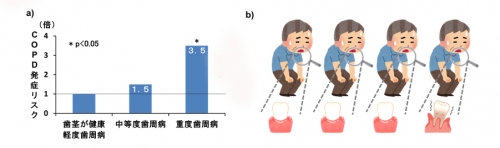 慢性疾患としての歯周病へのアプローチ患者さんの生涯にわたるQOLに貢献するために 慢性疾患としての歯周病へのアプローチ 患者さんの生涯にわたる