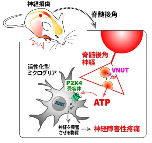 神経障害性疼痛のメカニズムが大きく前進！ミクログリア細胞を