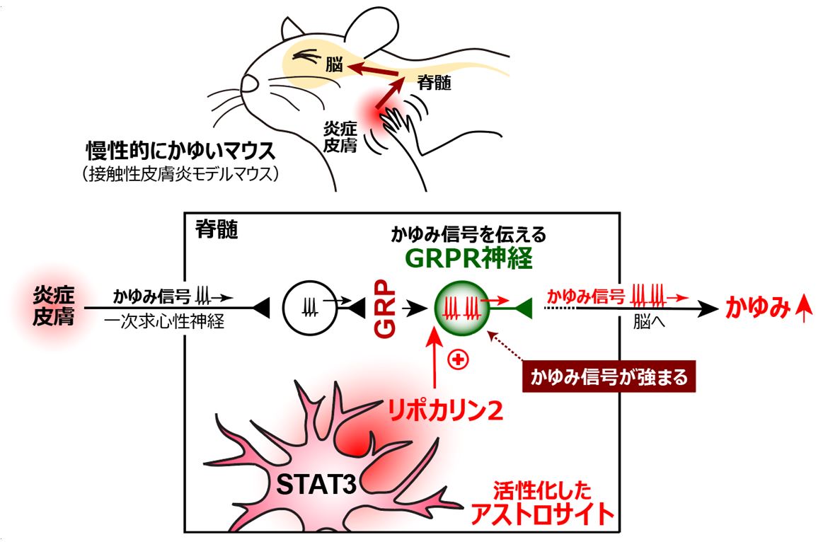 皮膚からのかゆみ信号が脊髄で強まってしまうメカニズムを発見 かゆみを鎮める治療薬の開発への応用に期待 研究成果 九州大学 Kyushu University