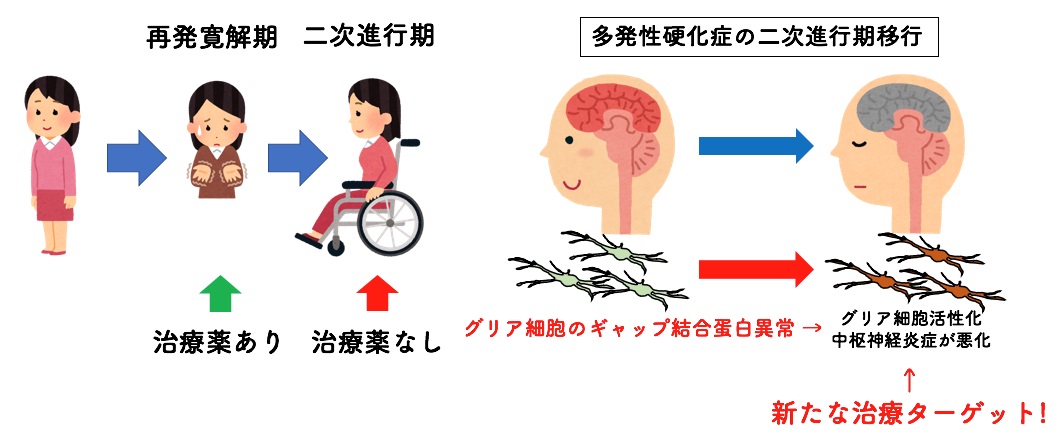 多発性硬化症の主な症状を知る