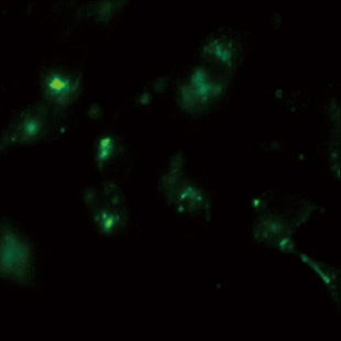 ACE2 internalization by exposure to SARS-CoV-2-derived Spike protein (produced by Prof. Kusakabe's group).