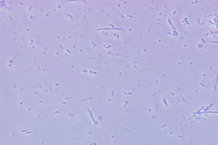 Oral microbiome microscope image