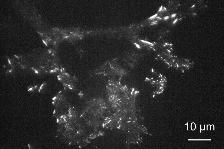 TIRF image of fibroblast on metasurface