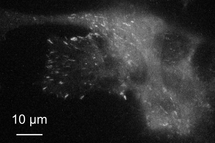 Epifluorescence image of cell on metasurface