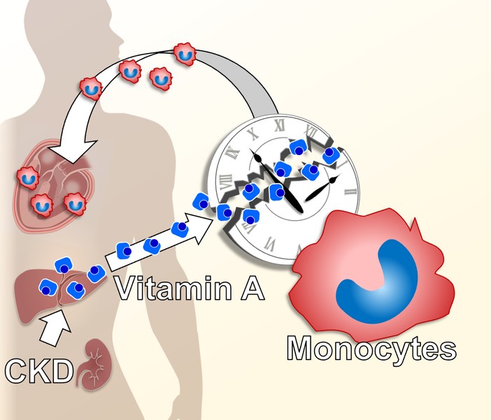 Molecular connection between chronic kidney disease and cardiovascular disease