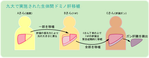 医師は人の肝臓をどの程度安全に切除できるのでしょうか?